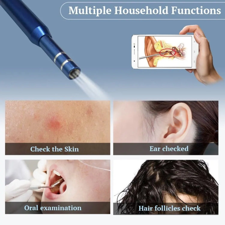 i95 3 in 1 USB Ear Scope Inspection HD 0.3MP Camera Visual Ear Spoon for OTG Android Phones & PC & MacBook, 1.75m Length Cable, 3 in 1 White 0.3MP