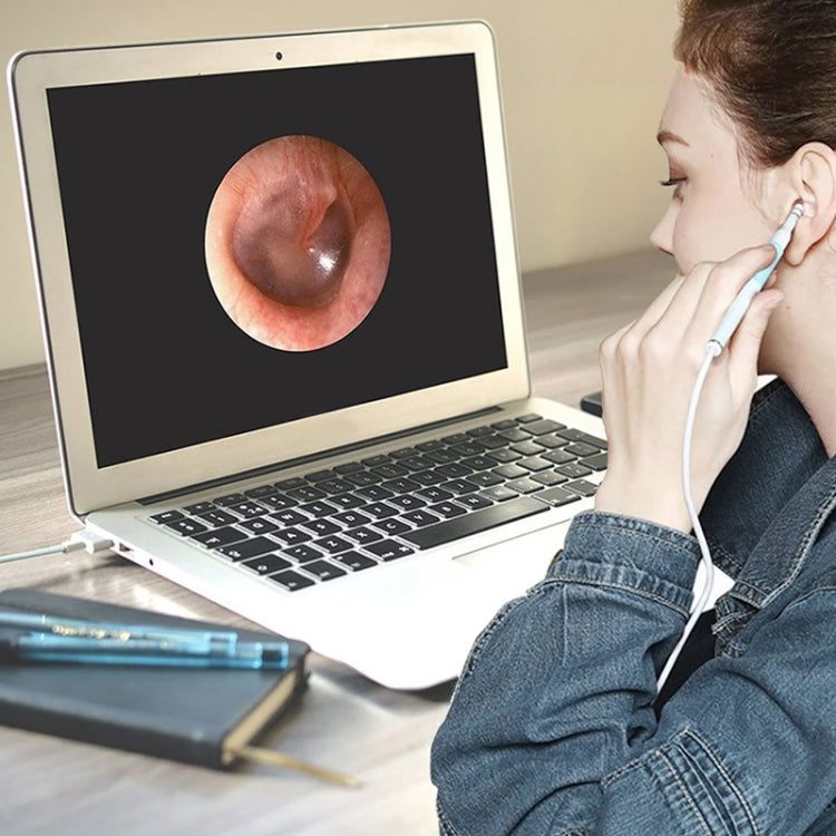 i95 3 in 1 USB Ear Scope Inspection HD 0.3MP Camera Visual Ear Spoon for OTG Android Phones & PC & MacBook, 1.75m Length Cable, 3 in 1 White 0.3MP
