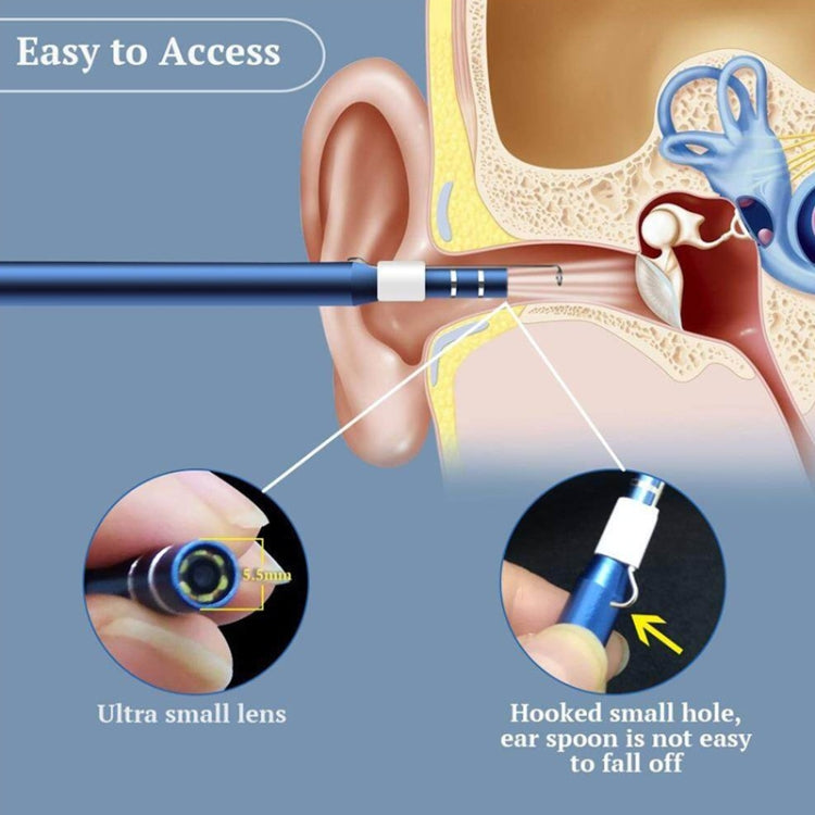 i95 3 in 1 USB Ear Scope Inspection HD 0.3MP Camera Visual Ear Spoon for OTG Android Phones & PC & MacBook, 1.75m Length Cable, 3 in 1 White 0.3MP