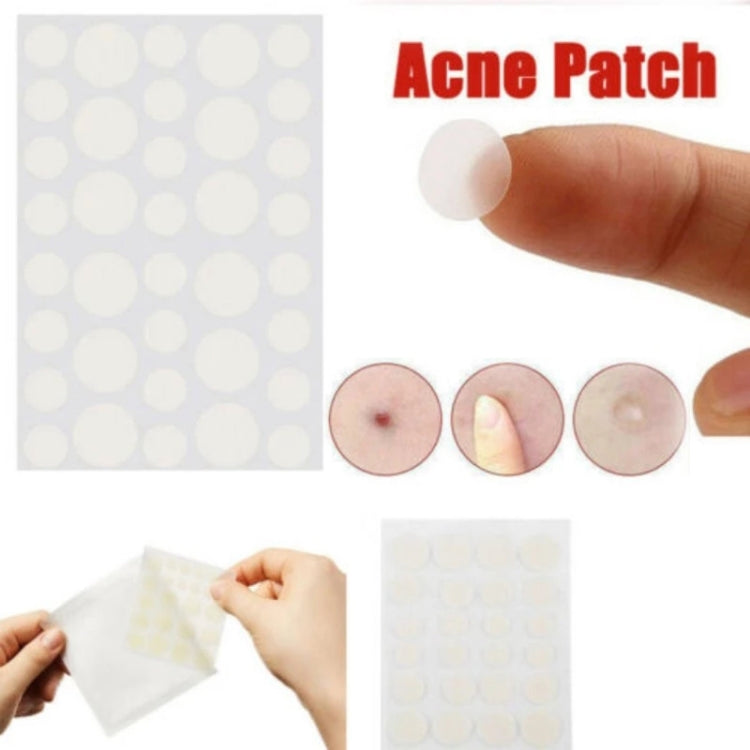 3 PCS Acne Tool Set Treatment Acne Scar Pimples Sticker