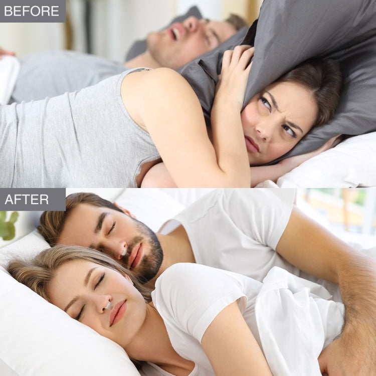 Magnetic Anti Snore Device Stop Snoring Nose Clip Sleeping Aid Apnea Guard, 1pc