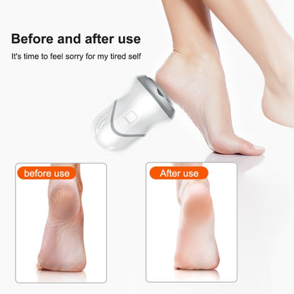 Electric Vacuum Design Foot Grinder Household Multifunctional Pedicure Calluses Foot Care, Silver Foot Grinder