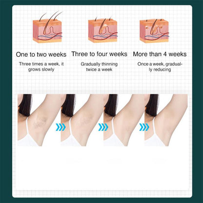 FY-B501 Laser Hair Removal Device Home Electric IPL Intense Pulse Hair Remover, EU Plug, US Plug, UK Plug