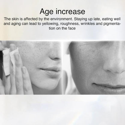 WG-M01 Milk Light Skin Rejuvenation Beauty Device Home Portable Photon Beauty Instrument, EU Plug, US Plug, UK Plug
