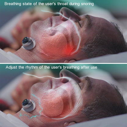 Adult Home Smart Throat Anti-snoring Device Sleep Stickers, YA4200