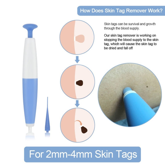 Skin Tag Removal Tool For 2mm-4mm Skin Tags, Skin Tag Removal Tool