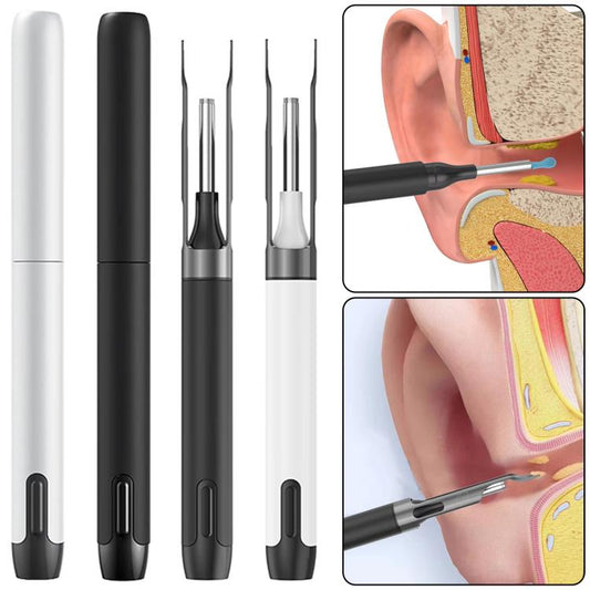 P5 Smart WIFI Connection Visible 10 Million Pixel HD Detachable Ear Spoon With APP